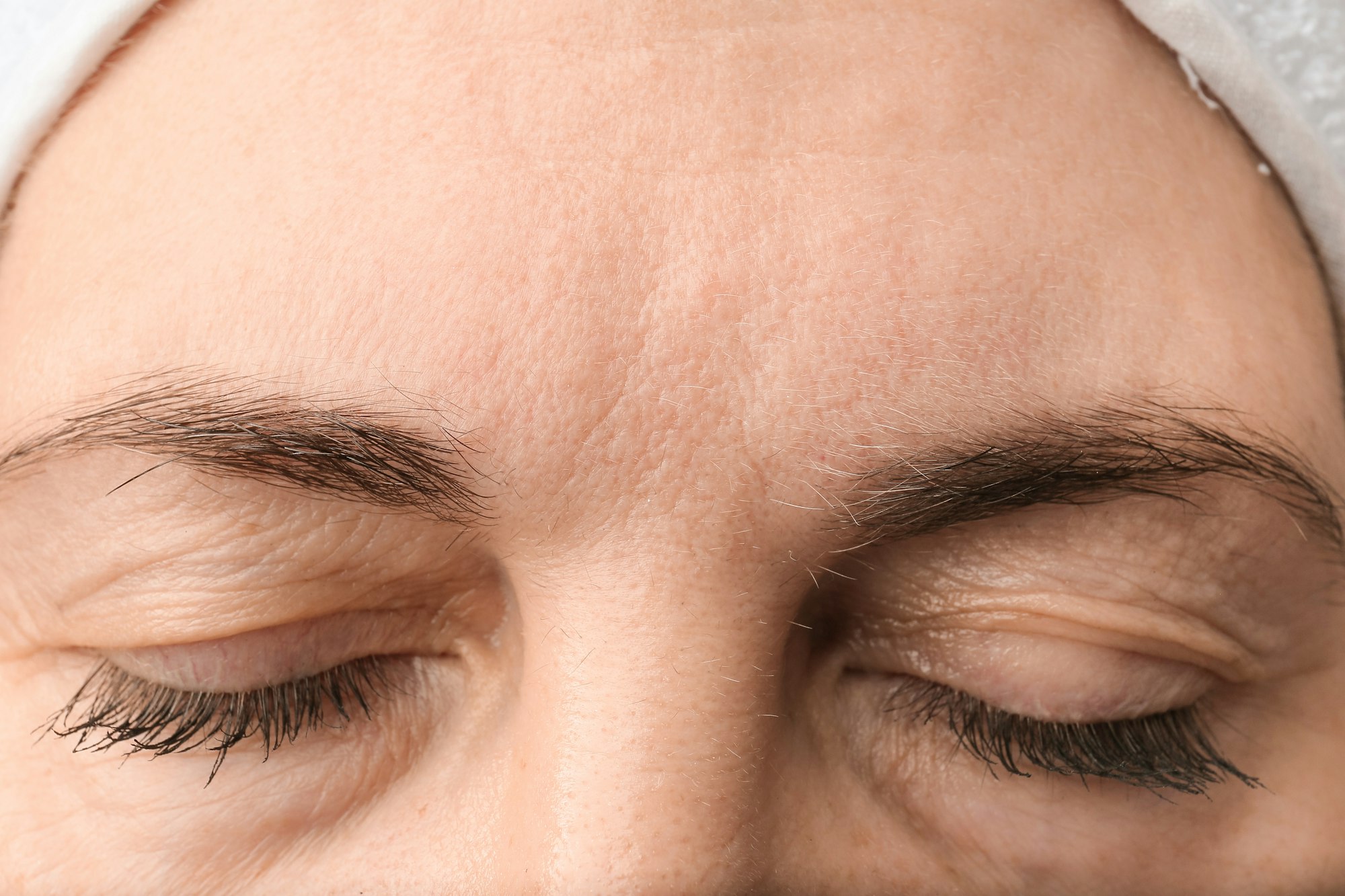 Female forehead with wrinkles