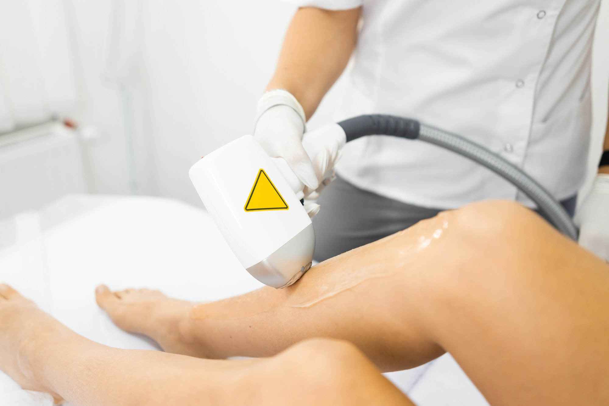 Laser hair removal of female legs close up